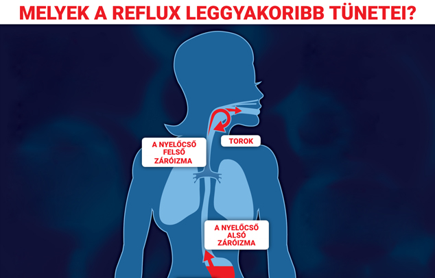 Melyek a reflux leggyakoribb tünetei - Borító